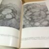 В.Х.Анестиади, Е.Г.Зота. Начинающийся атеросклероз — изображение 5