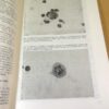 Иммунология и иммунопатология туберкулеза — изображение 4