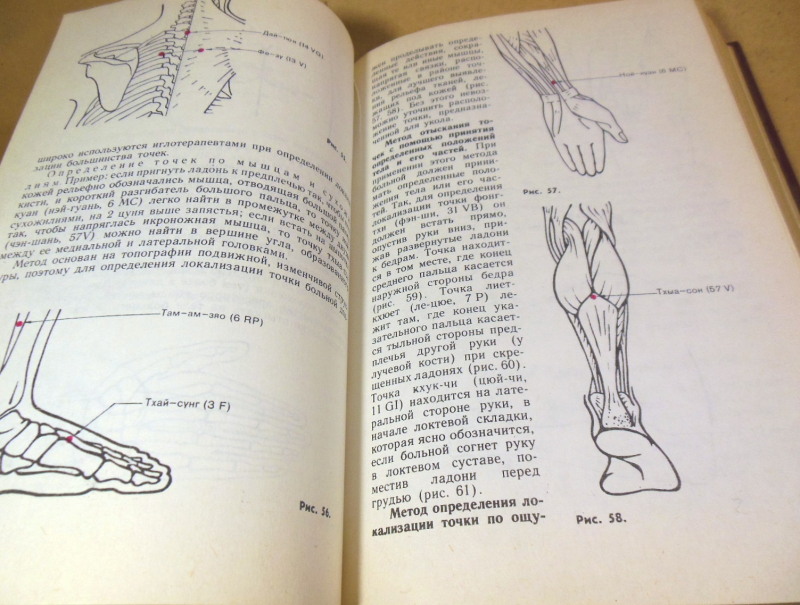 Хоанг Бао Тяу, Ла Куанг Ниеп, Иглоукалывание — изображение 4